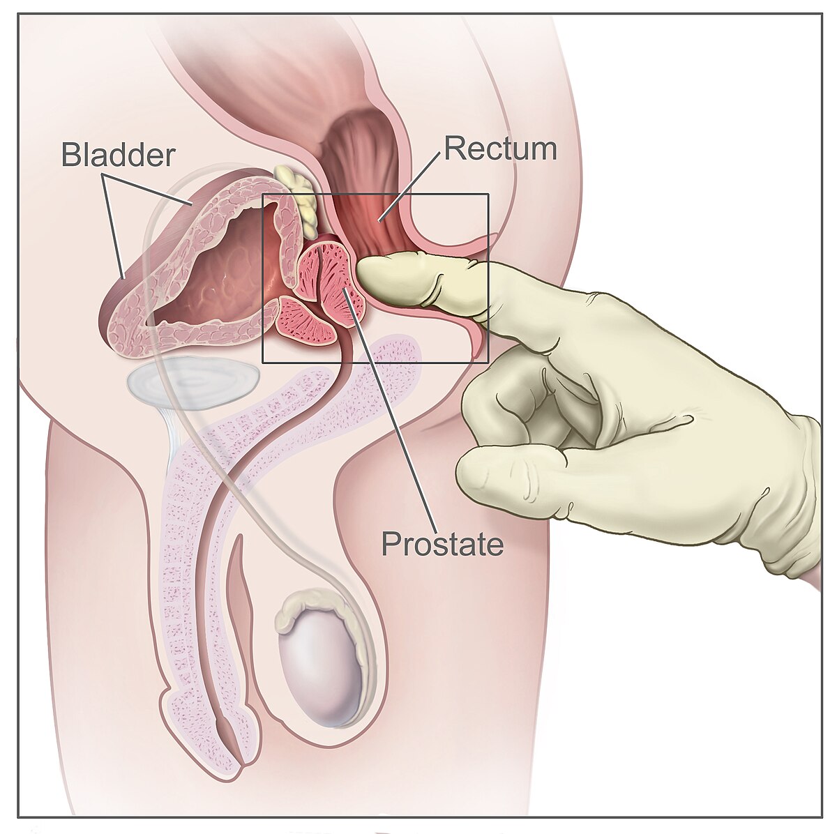 clay griffin add prostate stimulation stories image